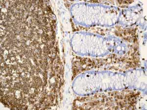Immunohistochemistry (Formalin/PFA-fixed paraffin-embedded sections) - Anti-CD45 antibody [EP322Y] - BSA and Azide free (AB214437)