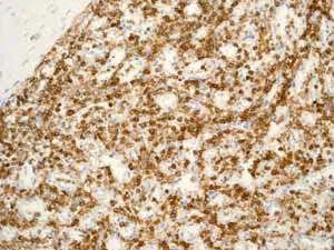Immunohistochemistry (Formalin/PFA-fixed paraffin-embedded sections) - Anti-CD45 antibody [EP322Y] - BSA and Azide free (AB214437)