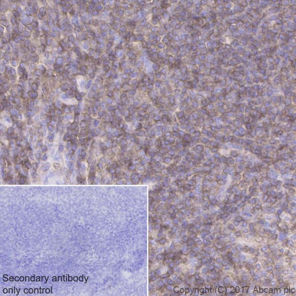 Immunohistochemistry (Formalin/PFA-fixed paraffin-embedded sections) - Anti-CD45 antibody [EPR20033] (AB208022), expandable thumbnail