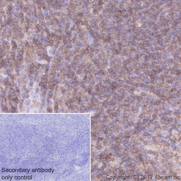 Immunohistochemistry (Formalin/PFA-fixed paraffin-embedded sections) - Anti-CD45 antibody [EPR20033] (AB208022)