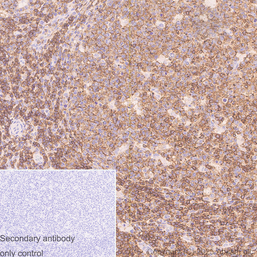 Immunohistochemistry (Formalin/PFA-fixed paraffin-embedded sections) - Anti-CD45 antibody [EPR20033] (ab208022), expandable thumbnail