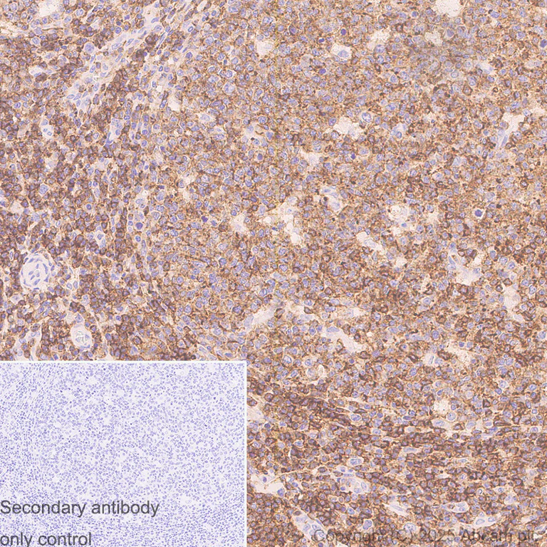 Immunohistochemistry (Formalin/PFA-fixed paraffin-embedded sections) - Anti-CD45 antibody [EPR20033] (AB208022)