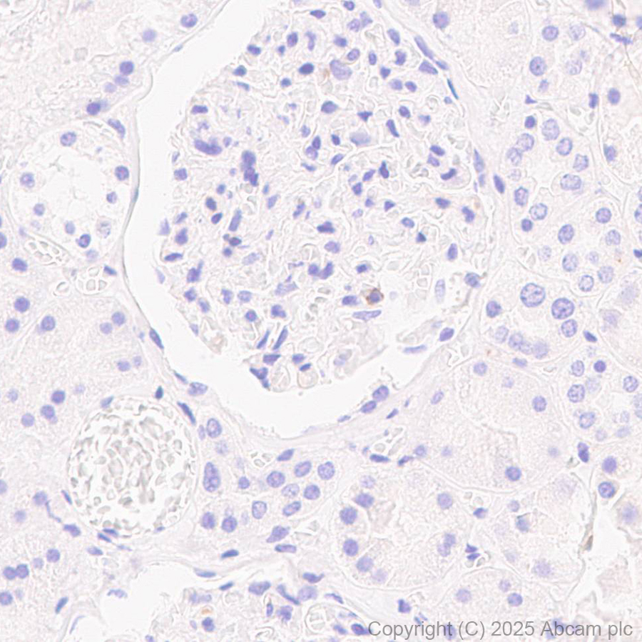 Immunohistochemistry (Formalin/PFA-fixed paraffin-embedded sections) - Anti-CD45 antibody [EPR20033] (ab208022), expandable thumbnail