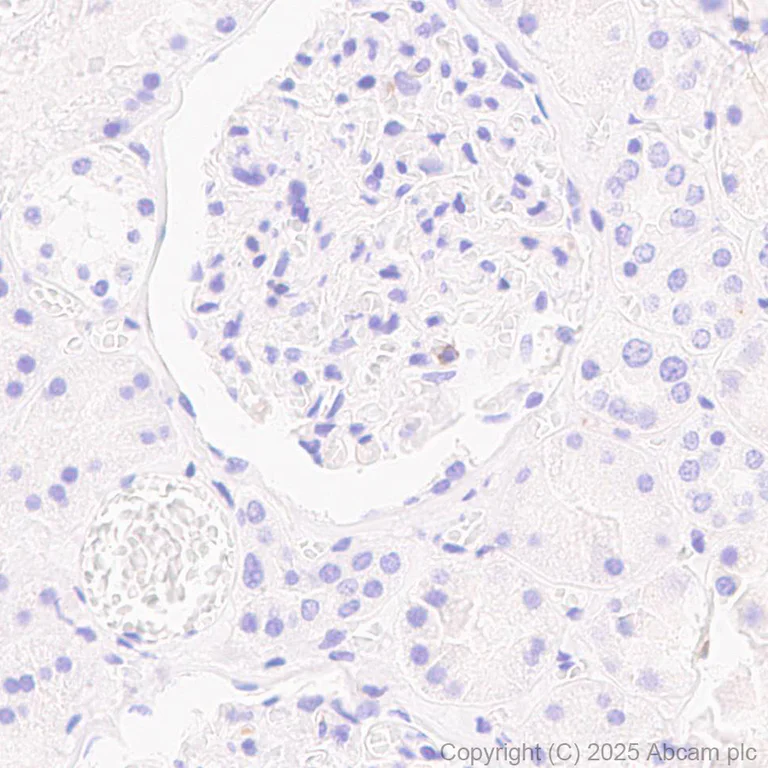 Immunohistochemistry (Formalin/PFA-fixed paraffin-embedded sections) - Anti-CD45 antibody [EPR20033] (AB208022)