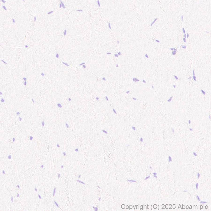 Immunohistochemistry (Formalin/PFA-fixed paraffin-embedded sections) - Anti-CD45 antibody [EPR20033] (ab208022), expandable thumbnail