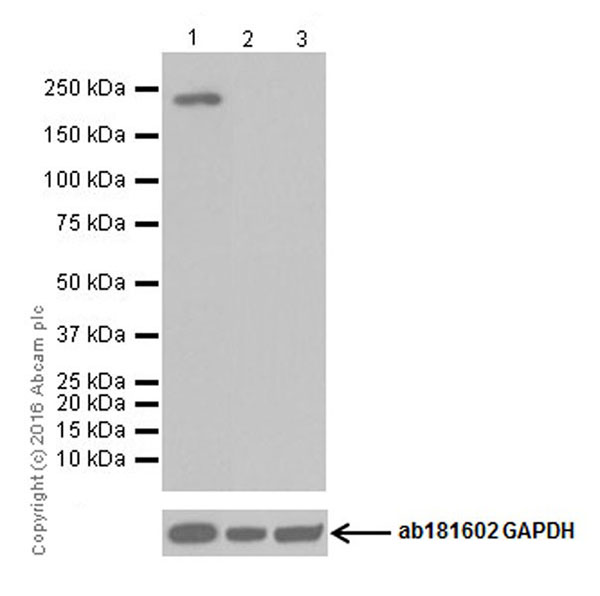 Western blot - Anti-CD45 antibody [EPR20033] (ab208022), expandable thumbnail