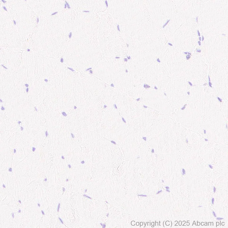 Immunohistochemistry (Formalin/PFA-fixed paraffin-embedded sections) - Anti-CD45 antibody [EPR20033] - BSA and Azide free (AB229292)
