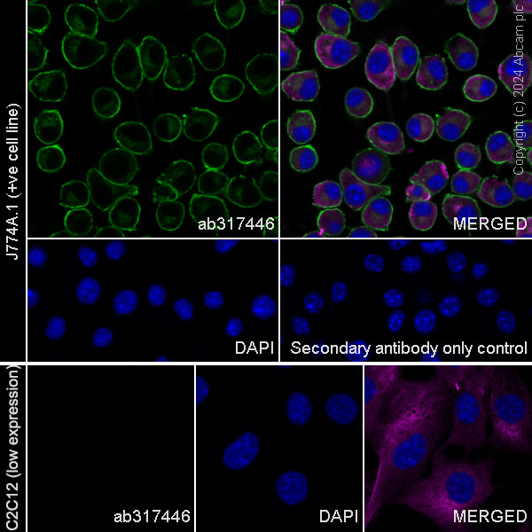 Immunocytochemistry/ Immunofluorescence - Anti-CD45 antibody [EPR28934-536] (ab317446), expandable thumbnail