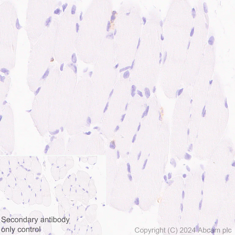 Immunohistochemistry (Formalin/PFA-fixed paraffin-embedded sections) - Anti-CD45 antibody [EPR28934-536] (AB317446)