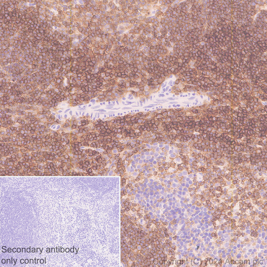 Immunohistochemistry (Formalin/PFA-fixed paraffin-embedded sections) - Anti-CD45 antibody [EPR28934-536] (ab317446), expandable thumbnail