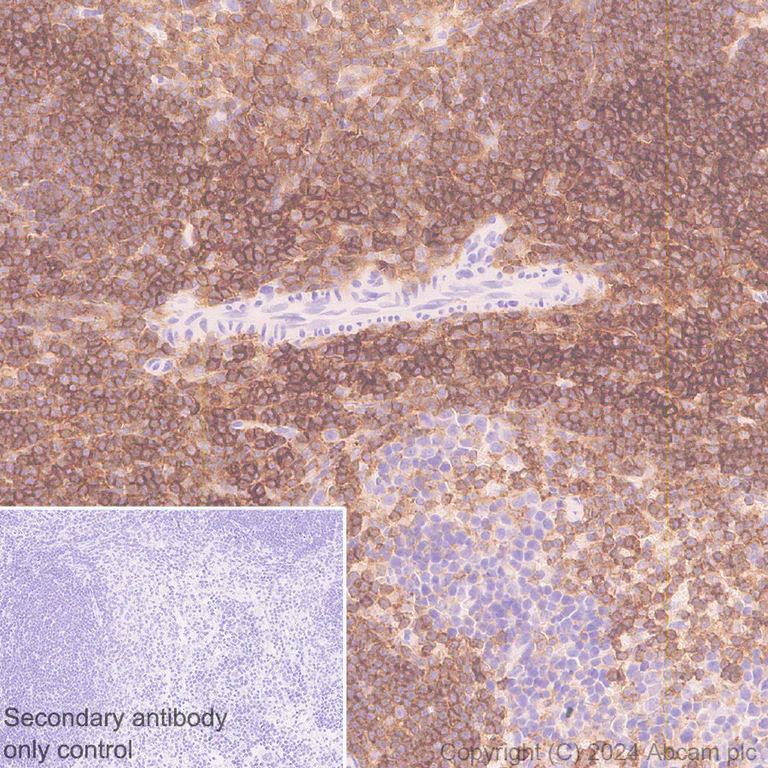 Immunohistochemistry (Formalin/PFA-fixed paraffin-embedded sections) - Anti-CD45 antibody [EPR28934-536] - BSA and Azide free (AB317447)