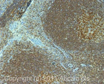 Immunohistochemistry (Formalin/PFA-fixed paraffin-embedded sections) - Anti-CD45 antibody [F10-89-4] - BSA and Azide free (AB230296)