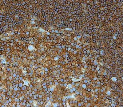 Immunohistochemistry (Formalin/PFA-fixed paraffin-embedded sections) - Anti-CD45 antibody - Hematopoietic Stem Cell Marker (AB10559)
