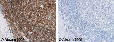 Immunohistochemistry (Formalin/PFA-fixed paraffin-embedded sections) - Anti-CD45 antibody [MEM-28] (AB8216)