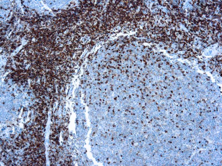 Immunohistochemistry (Formalin/PFA-fixed paraffin-embedded sections) - Anti-CD45 antibody [PD7/26 + 2B11] (AB781)