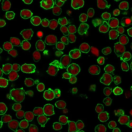 Immunocytochemistry - Anti-CD45 antibody [PTPRC/1461] (AB218503)