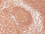 Immunohistochemistry (Formalin/PFA-fixed paraffin-embedded sections) - Anti-CD45 antibody [PTPRC/1461] (AB218503)