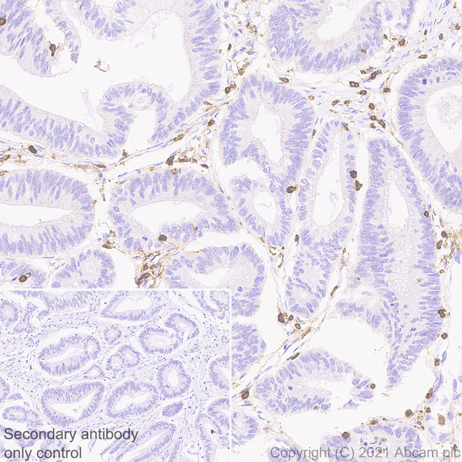 Immunohistochemistry (Formalin/PFA-fixed paraffin-embedded sections) - Anti-CD45 antibody [RM1007] (AB281586), expandable thumbnail