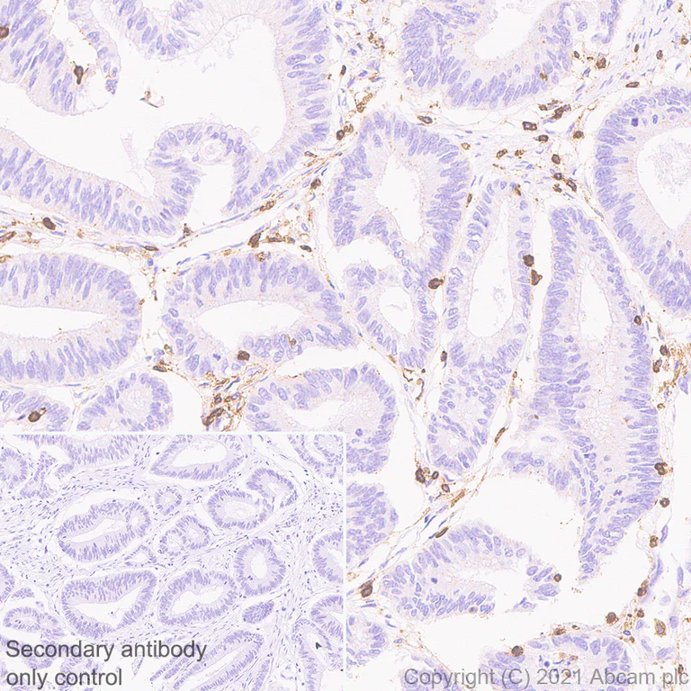 Immunohistochemistry (Formalin/PFA-fixed paraffin-embedded sections) - Anti-CD45 antibody [RM1007] (AB281586)