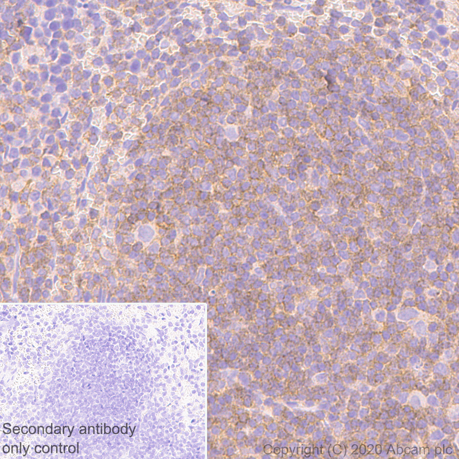 Immunohistochemistry (Formalin/PFA-fixed paraffin-embedded sections) - Anti-CD45 antibody [RM1007] (ab281586), expandable thumbnail