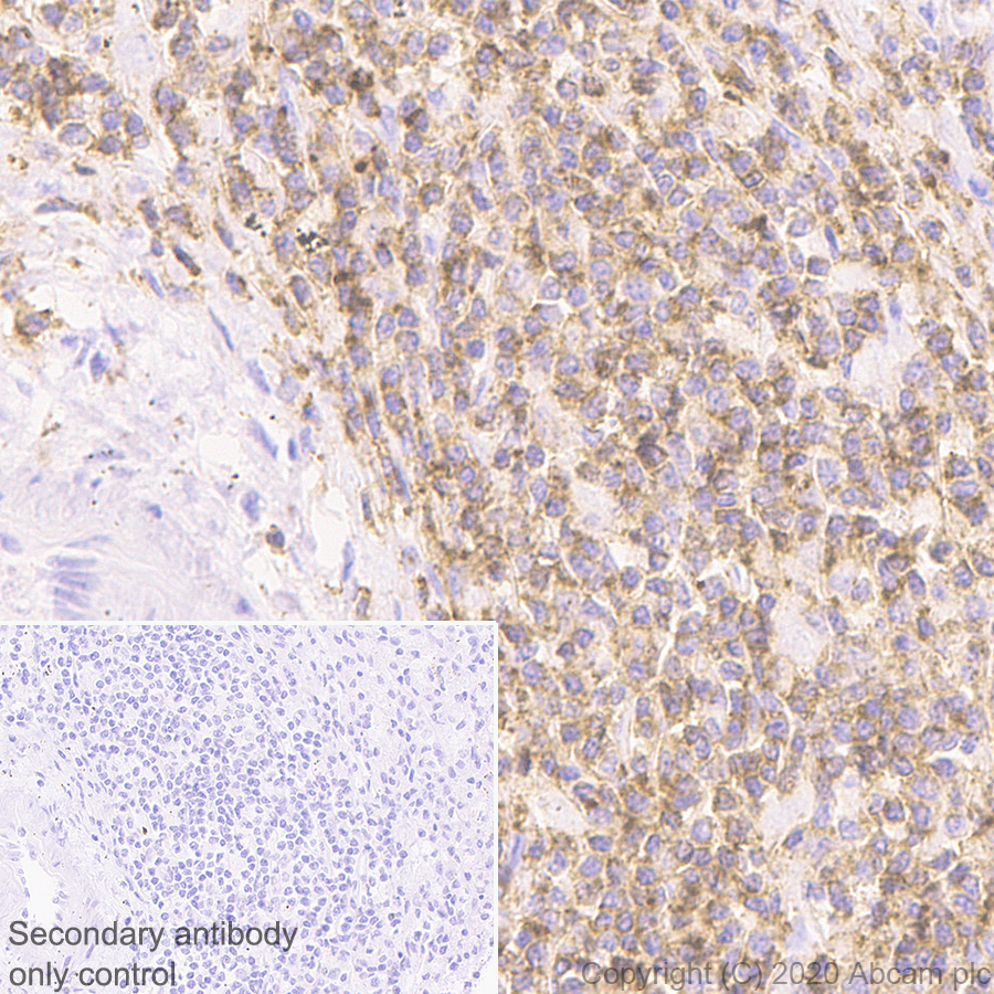 Immunohistochemistry (Formalin/PFA-fixed paraffin-embedded sections) - Anti-CD45 antibody [RM1007] (AB281586), expandable thumbnail