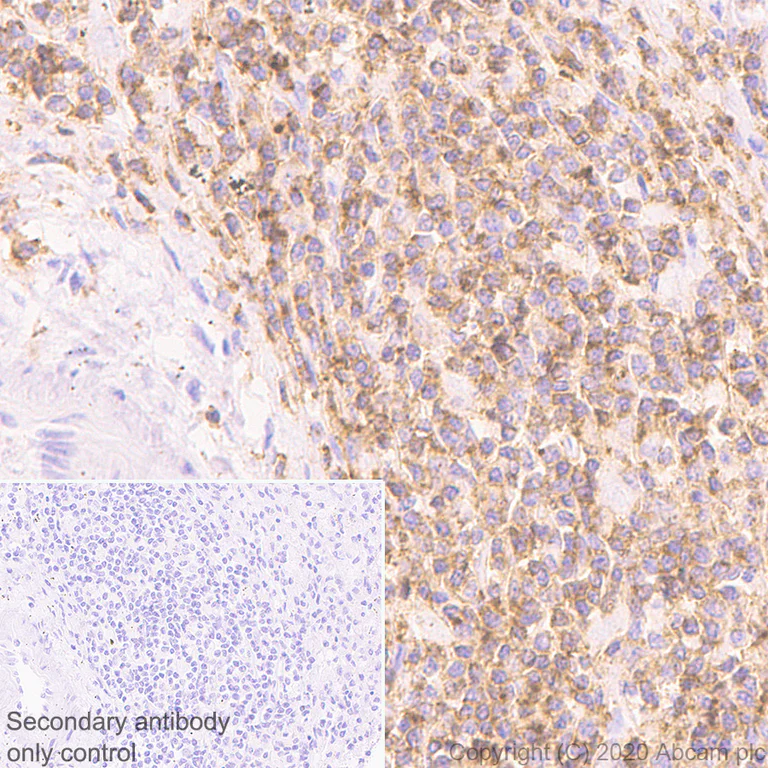 Immunohistochemistry (Formalin/PFA-fixed paraffin-embedded sections) - Anti-CD45 antibody [RM1007] (AB281586)