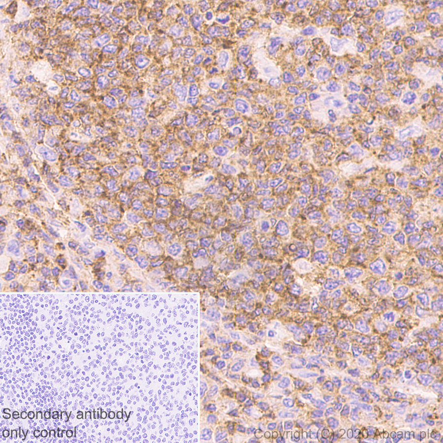 Immunohistochemistry (Formalin/PFA-fixed paraffin-embedded sections) - Anti-CD45 antibody [RM1007] (AB281586), expandable thumbnail