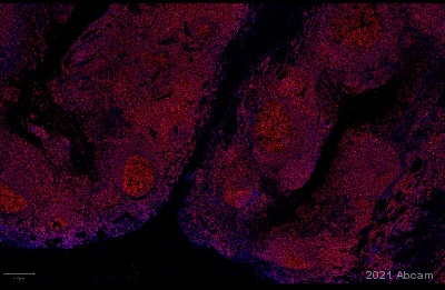 Immunohistochemistry (Formalin/PFA-fixed paraffin-embedded sections) - Anti-CD45 antibody [RM1007] (ab281586), expandable thumbnail