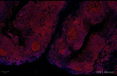 Immunohistochemistry (Formalin/PFA-fixed paraffin-embedded sections) - Anti-CD45 antibody [RM1007] (AB281586)