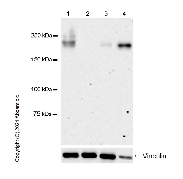 Western blot - Anti-CD45 antibody [RM1007] (AB281586), expandable thumbnail