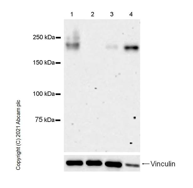 Western blot - Anti-CD45 antibody [RM1007] (AB281586)