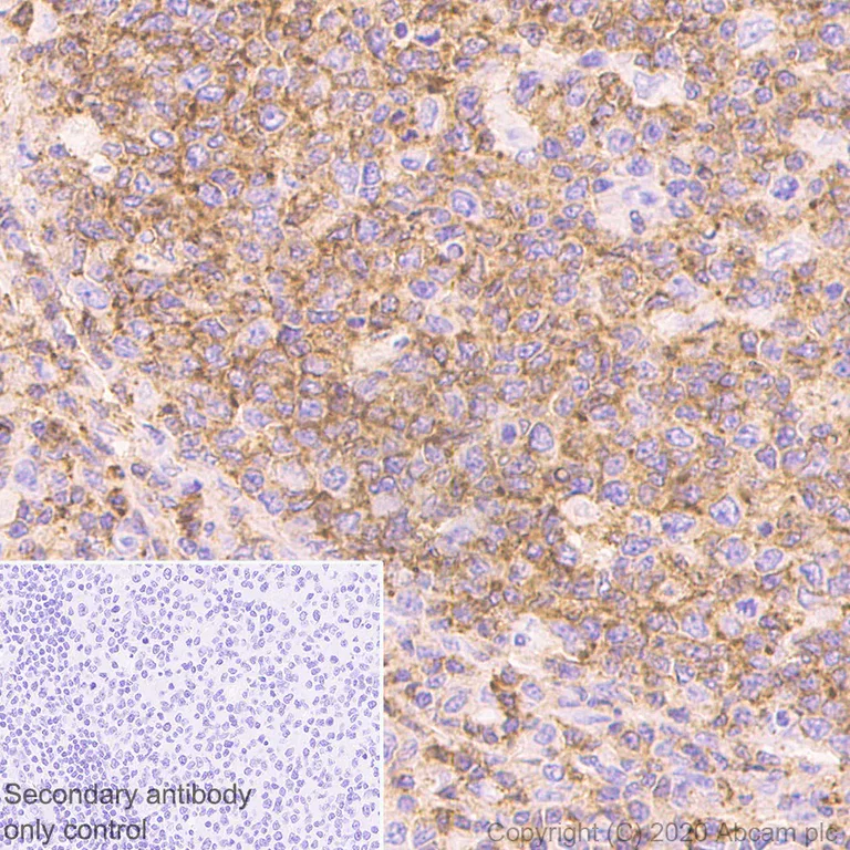 Immunohistochemistry (Formalin/PFA-fixed paraffin-embedded sections) - Anti-CD45 antibody [RM1007] - BSA and Azide free (AB282747)