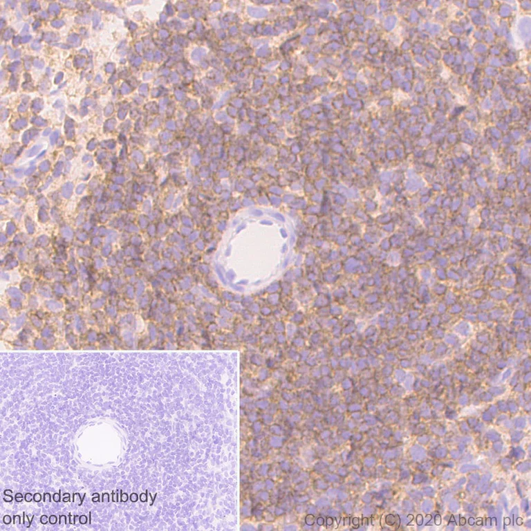 Immunohistochemistry (Formalin/PFA-fixed paraffin-embedded sections) - Anti-CD45 antibody [RM1007] - BSA and Azide free (AB282747)