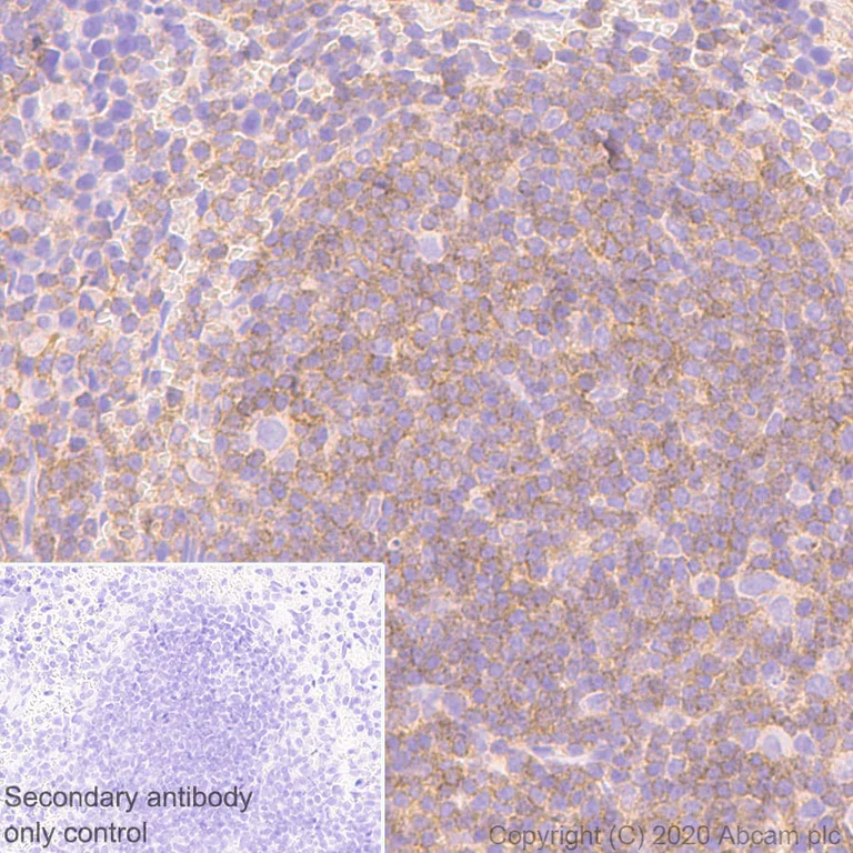 Immunohistochemistry (Formalin/PFA-fixed paraffin-embedded sections) - Anti-CD45 antibody [RM1007] - BSA and Azide free (AB282747)