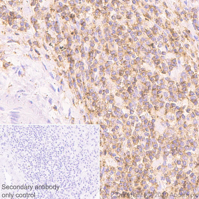 Immunohistochemistry (Formalin/PFA-fixed paraffin-embedded sections) - Anti-CD45 antibody [RM1007] - BSA and Azide free (AB282747)