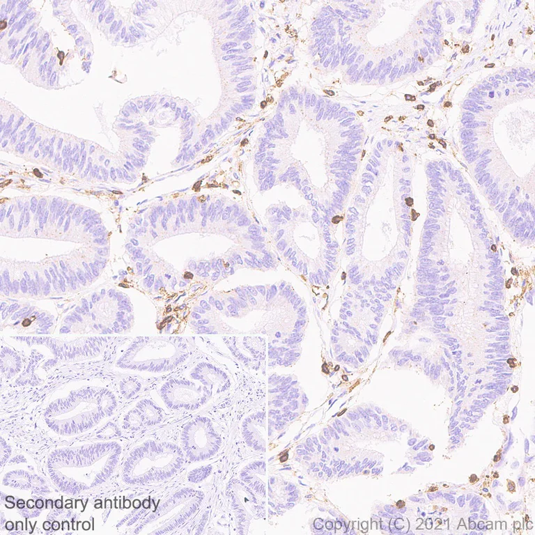 Immunohistochemistry (Formalin/PFA-fixed paraffin-embedded sections) - Anti-CD45 antibody [RM1007] - BSA and Azide free (AB282747)