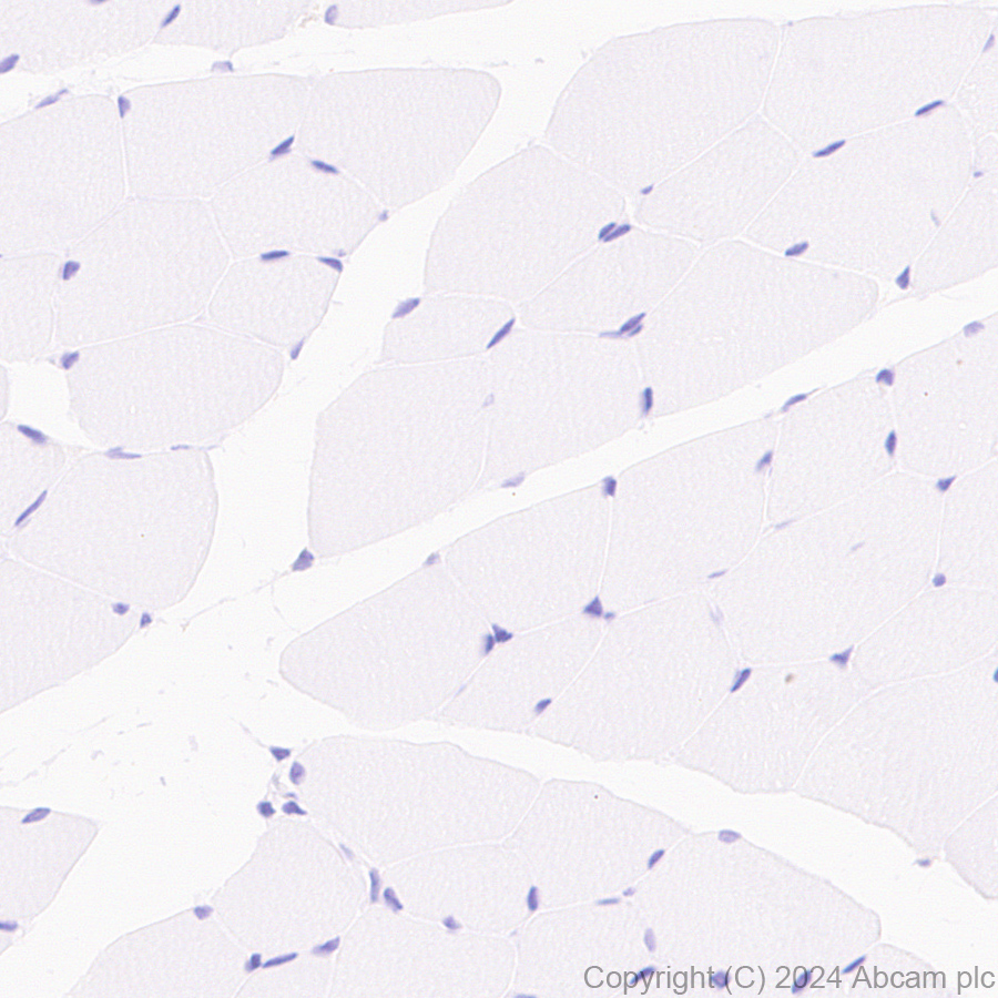 Immunohistochemistry (Formalin/PFA-fixed paraffin-embedded sections) - Anti-CD45 antibody [RM2051] (ab318154), expandable thumbnail
