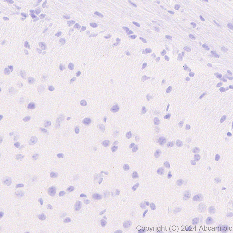 Immunohistochemistry (Formalin/PFA-fixed paraffin-embedded sections) - Anti-CD45 antibody [RM2051] (AB318154), expandable thumbnail