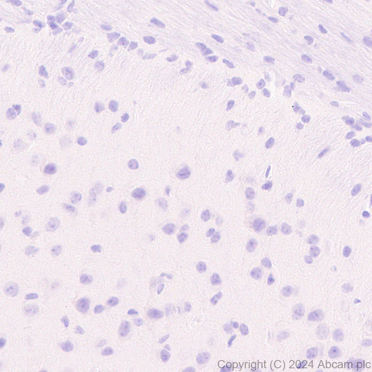 Immunohistochemistry (Formalin/PFA-fixed paraffin-embedded sections) - Anti-CD45 antibody [RM2051] (AB318154)