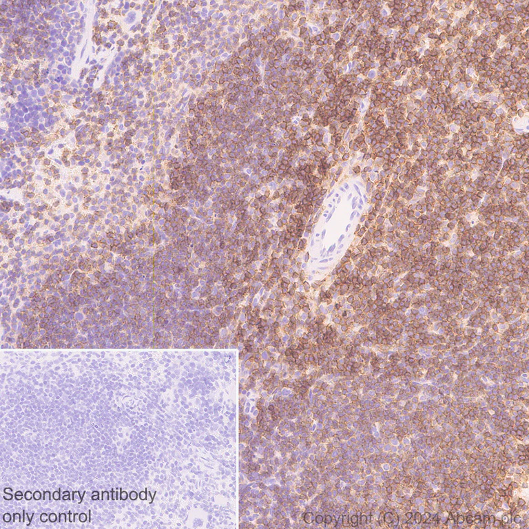 Immunohistochemistry (Formalin/PFA-fixed paraffin-embedded sections) - Anti-CD45 antibody [RM2051] - BSA and Azide free (AB318155)