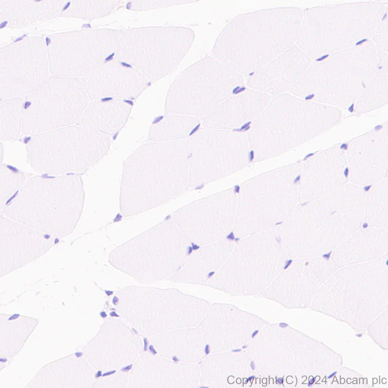 Immunohistochemistry (Formalin/PFA-fixed paraffin-embedded sections) - Anti-CD45 antibody [RM2051] - BSA and Azide free (AB318155)