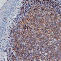 Immunohistochemistry (Formalin/PFA-fixed paraffin-embedded sections) - Anti-CD45RA antibody [F8-11-13] (AB59168)