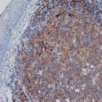 Immunohistochemistry (Formalin/PFA-fixed paraffin-embedded sections) - Anti-CD45RA antibody [F8-11-13] (AB59168)