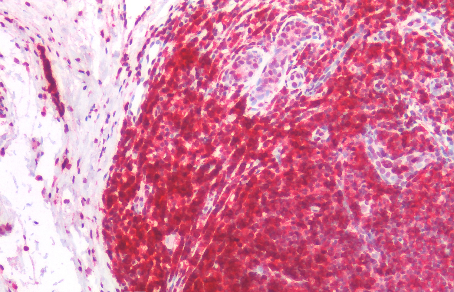 Immunohistochemistry (Formalin/PFA-fixed paraffin-embedded sections) - Anti-CD45RA antibody [MEM-56] (AB8217), expandable thumbnail