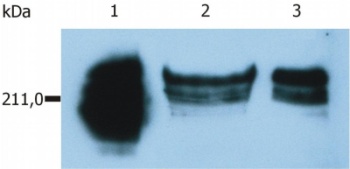 Western blot - Anti-CD45RA antibody [MEM-56] (AB8217), expandable thumbnail