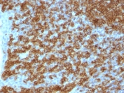 Immunohistochemistry (Formalin/PFA-fixed paraffin-embedded sections) - Anti-CD45RA antibody [PTPRC/1148] - BSA and Azide free (AB212774)