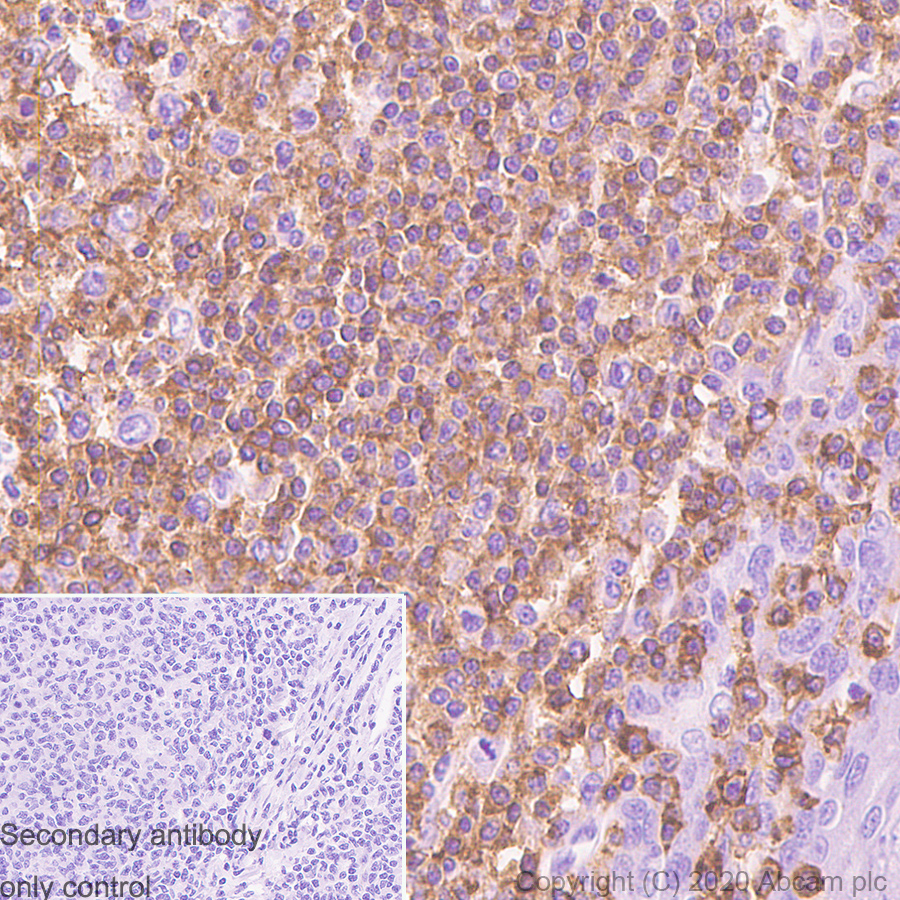Immunohistochemistry (Formalin/PFA-fixed paraffin-embedded sections) - Anti-CD45RA antibody [SPM504] - BSA and Azide free (AB289799), expandable thumbnail
