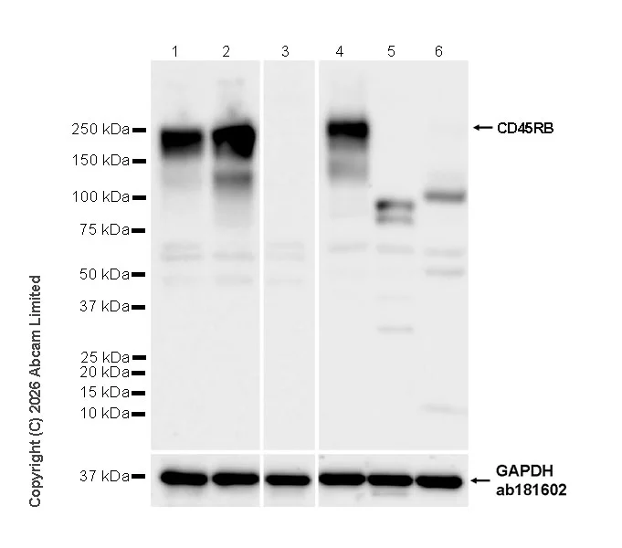 Western blot - Anti-CD45RB antibody [EPR31068-523] (AB326720)