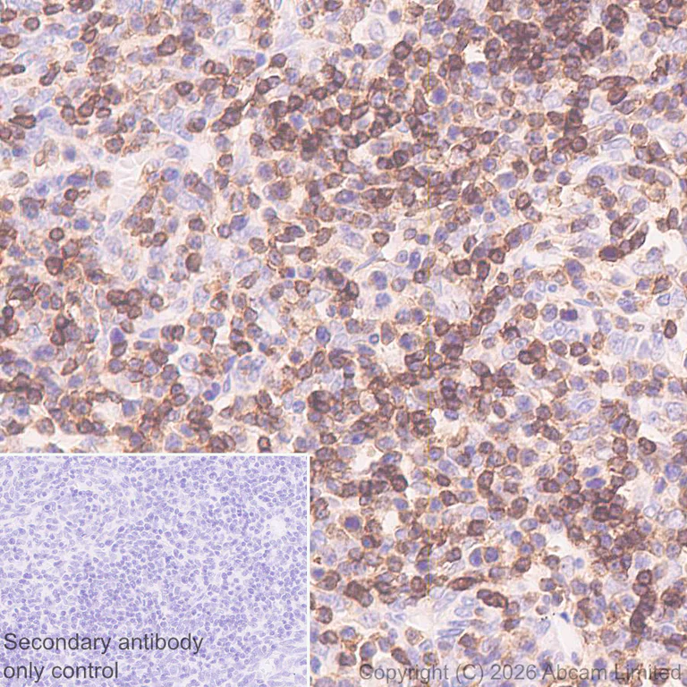 Immunohistochemistry (Formalin/PFA-fixed paraffin-embedded sections) - Anti-CD45RB antibody [EPR31068-523] - BSA and Azide free (AB326731)