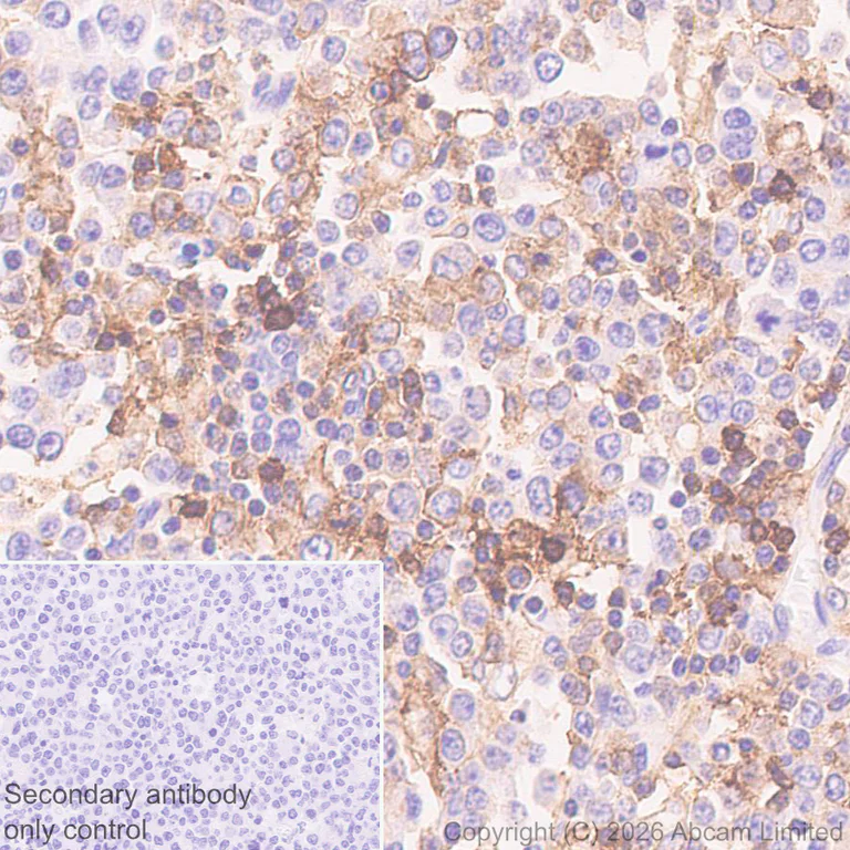 Immunohistochemistry (Formalin/PFA-fixed paraffin-embedded sections) - Anti-CD45RB antibody [EPR31068-523] - BSA and Azide free (AB326731)